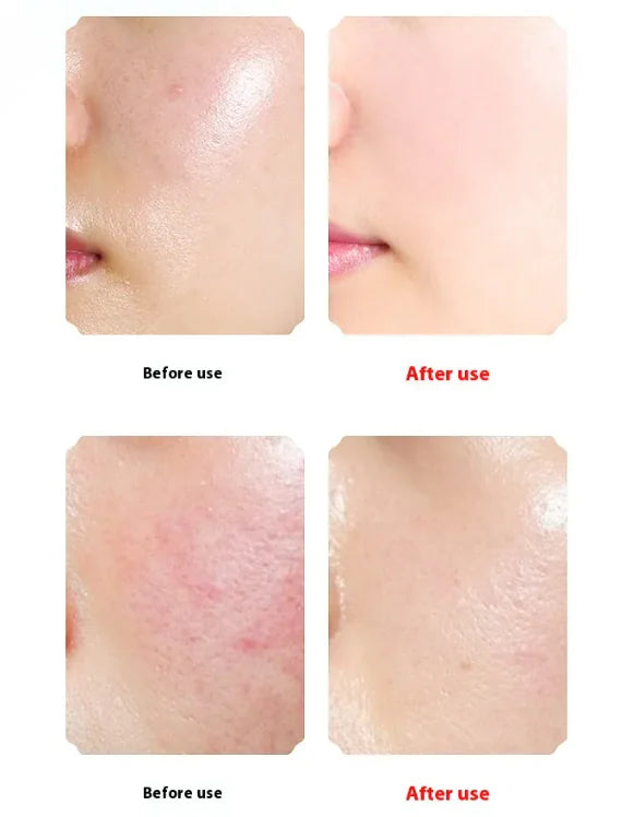 Electric Facial Cleanser