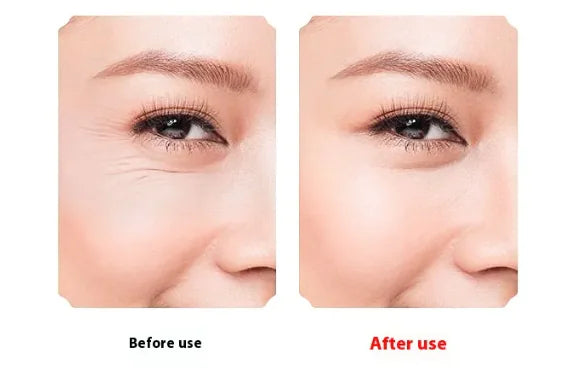 Electric Facial Cleanser